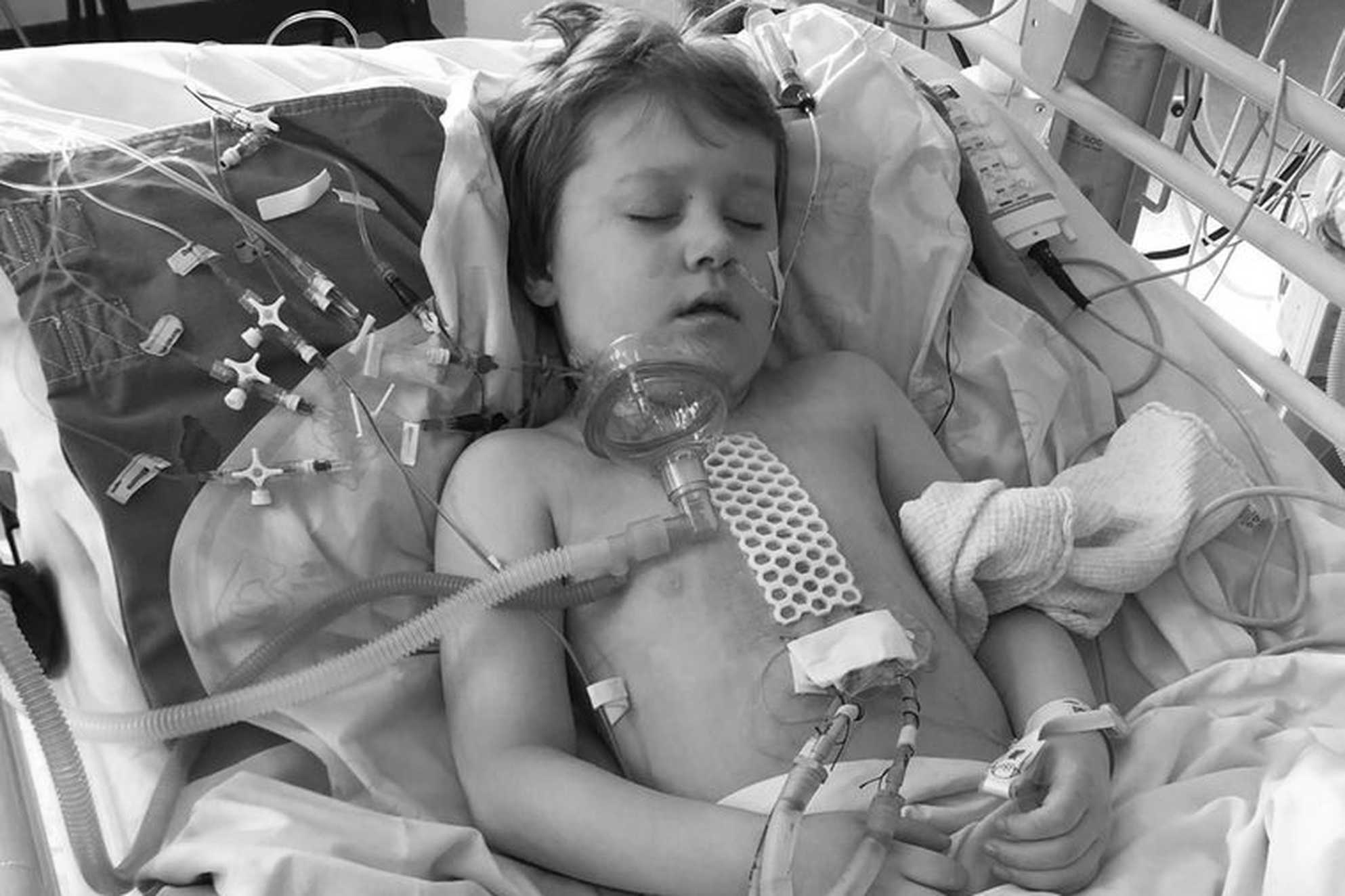 A black and white image of George undergoing treatment in hospital at six years of age.
