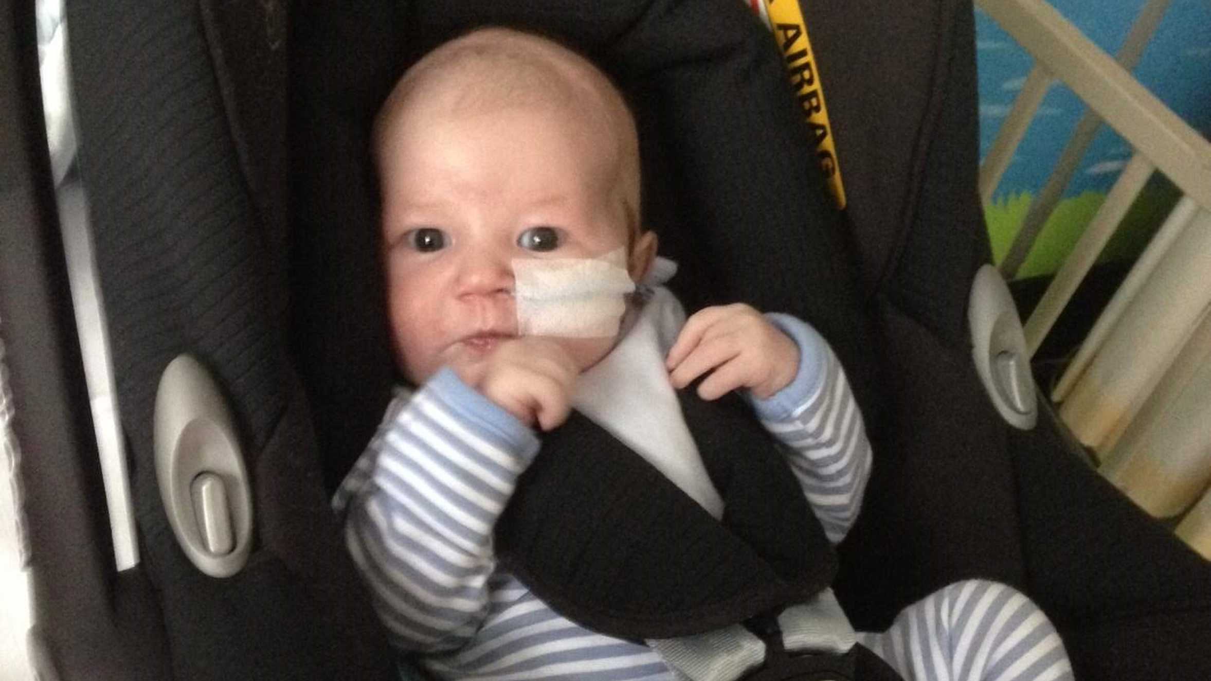 Scott when he was a baby, with a feeding tube in place.