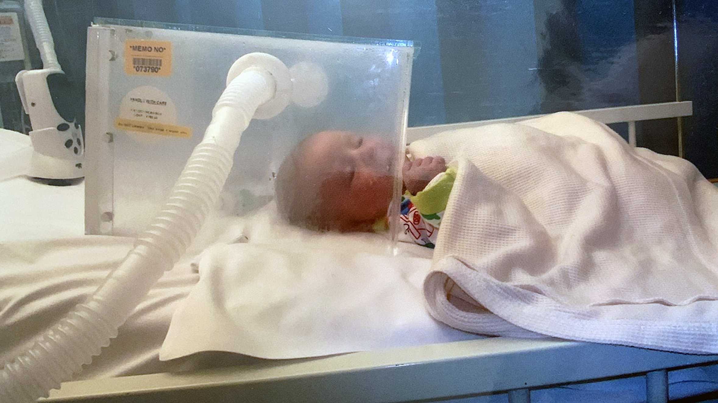 Archie as a baby, on an incubator during treatment in hospital for his condition.