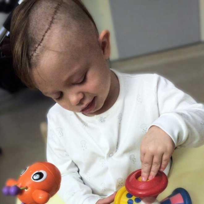 Archie recovering after his operation, with some of his hair shaved, revealing a large scar from the surgery.