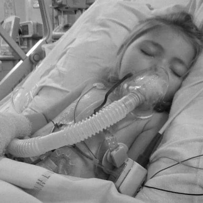 Eloise on a ventilator in hospital during treatment for her condition.