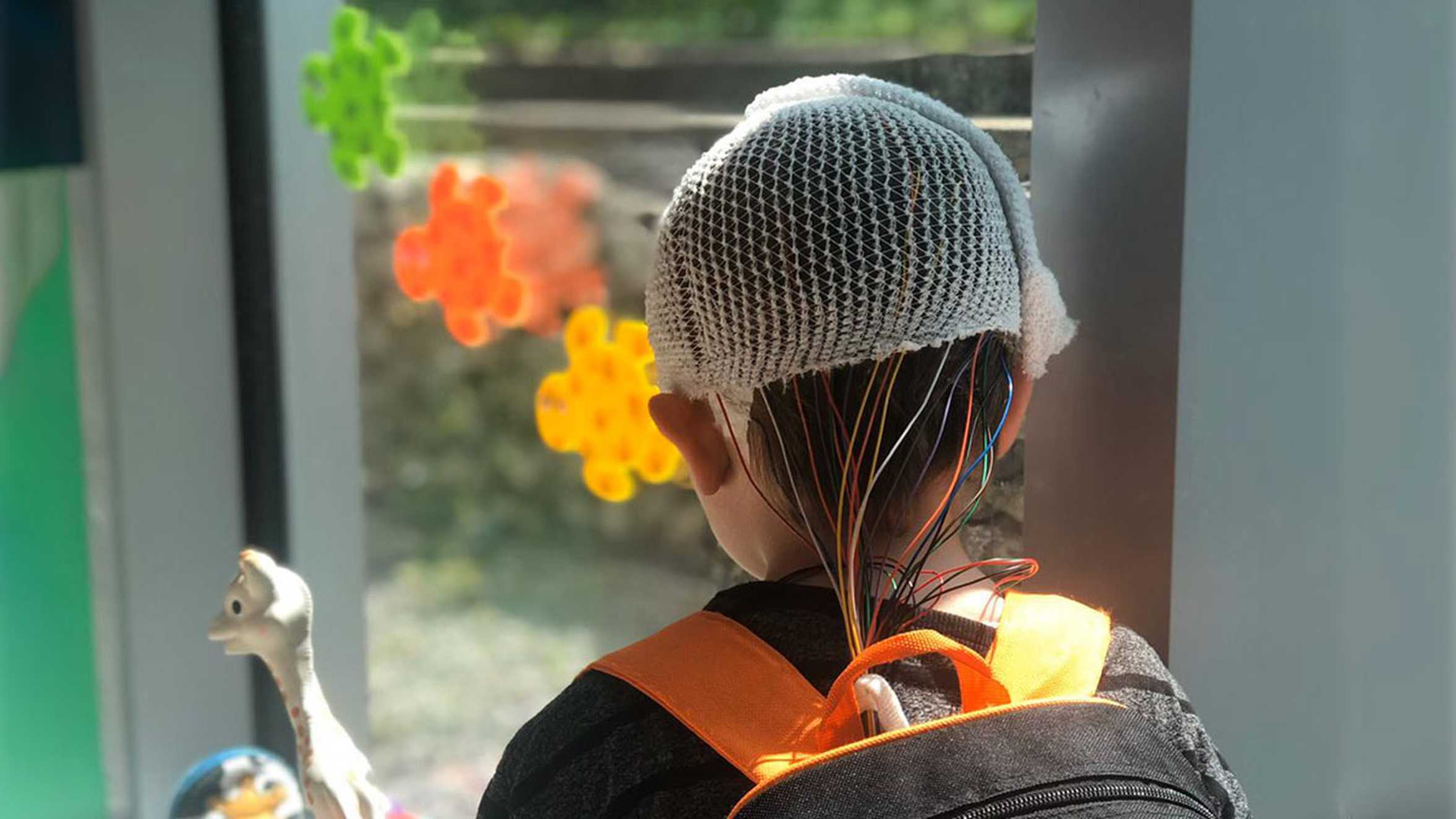 Archie wearing some monitoring equipment on his head during his treatment.