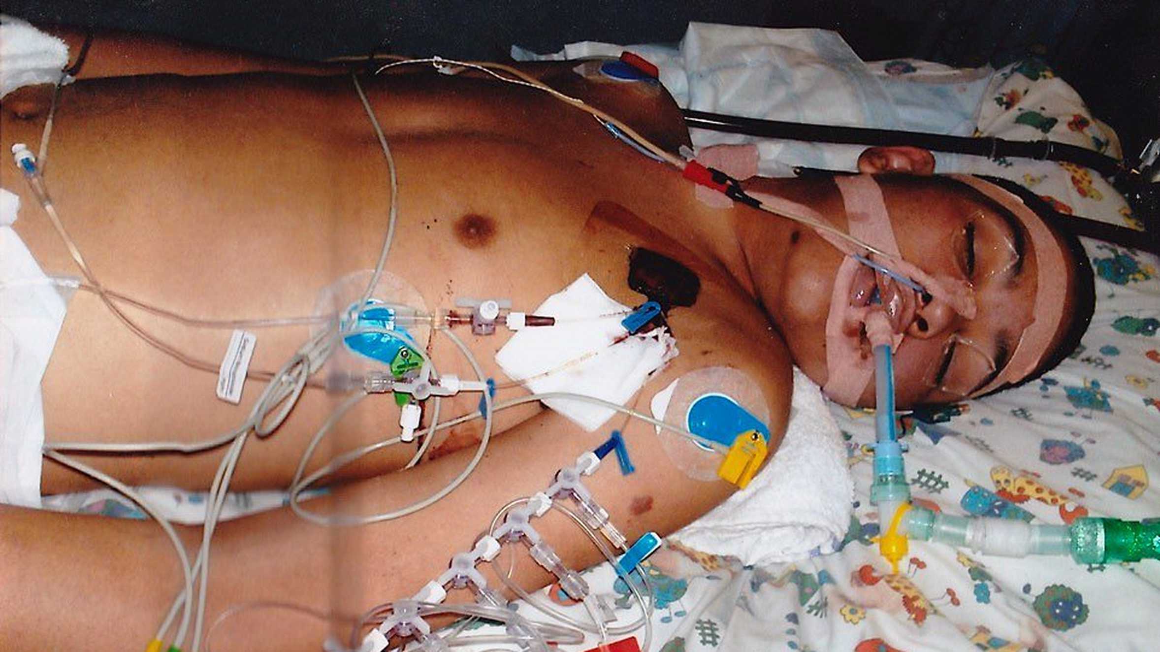 Anthony on a ventilator in his hospital bed, during treatment for his illness.